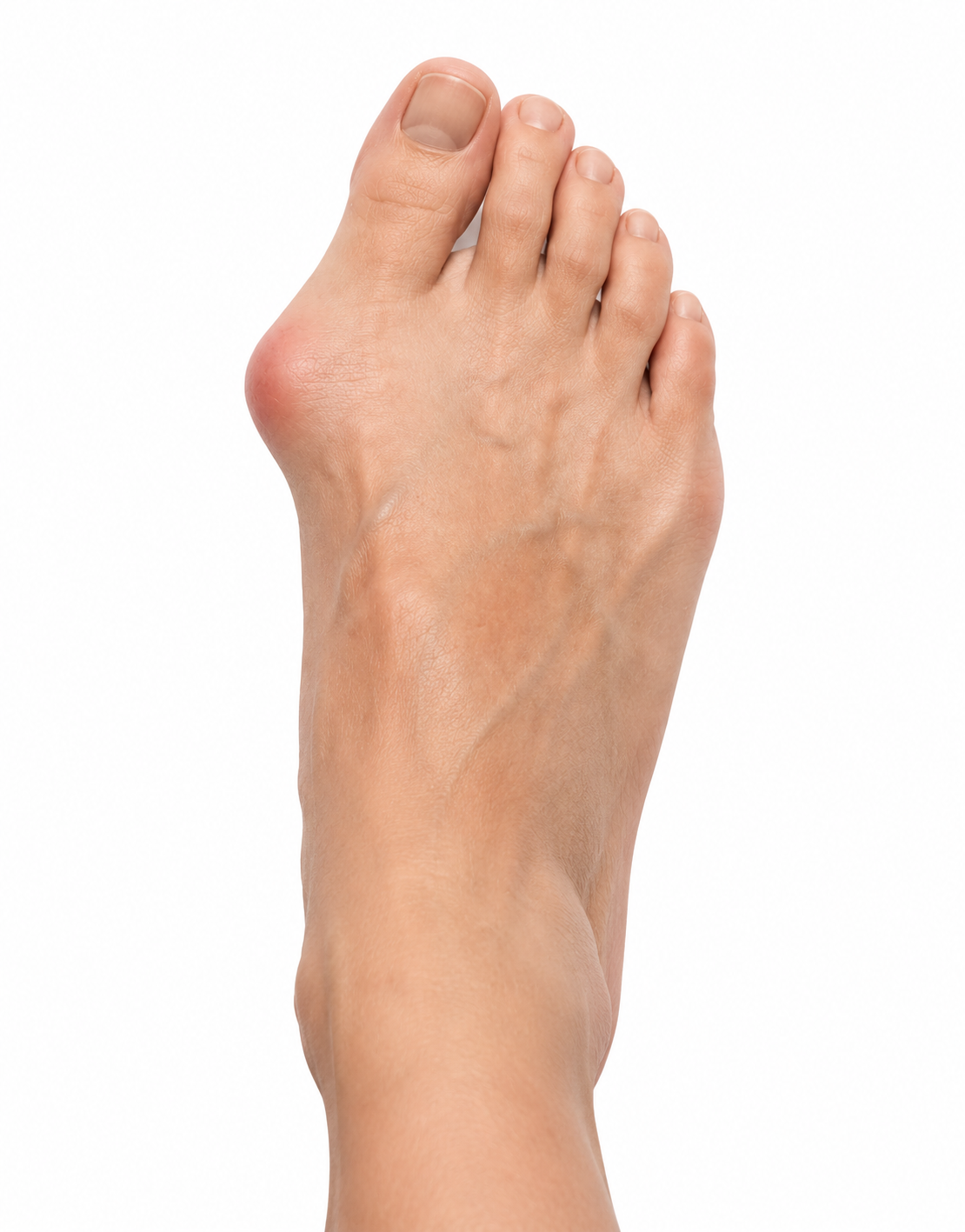 Pied avec Kinesio-Pad™